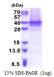 Human PIH1D1 protein, His tag. GTX57533-pro