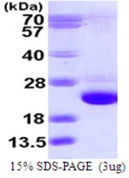 Human RAB24 protein, His tag. GTX57534-pro