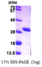 Human Adenylate kinase 4 protein, His tag. GTX57536-pro