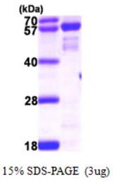 Human NMT2 protein, His tag. GTX57539-pro