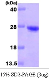 Human CDO1 protein, His tag. GTX57540-pro