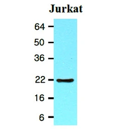 Anti-Bid antibody [4D3] used in Western Blot (WB). GTX57542