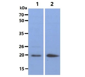 Anti-Bid antibody [4D3] used in Western Blot (WB). GTX57542