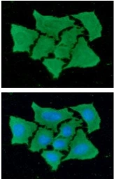 Anti-FABP4 antibody [3F4] used in Immunocytochemistry/ Immunofluorescence (ICC/IF). GTX57547
