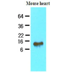 Anti-FABP4 antibody [3F4] used in Western Blot (WB). GTX57547