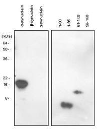 Anti-alpha Synuclein antibody [5C2] used in Western Blot (WB). GTX57554