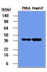 Anti-Nucleophosmin antibody [5E3] used in Western Blot (WB). GTX57555