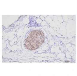 Anti-PGP9.5 antibody [3D9] used in IHC (Paraffin sections) (IHC-P). GTX57556