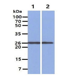 Anti-PGP9.5 antibody [3D9] used in Western Blot (WB). GTX57556