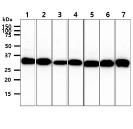 Anti-CBR3 antibody [AT7E8] used in Western Blot (WB). GTX57565