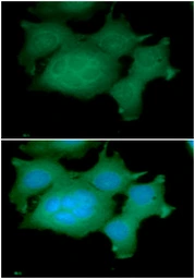 Anti-ADRM1 antibody [AT34C2] used in Immunocytochemistry/ Immunofluorescence (ICC/IF). GTX57566