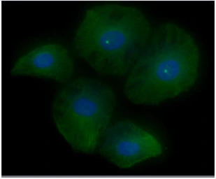 Anti-RAS antibody [AT2G9] used in Immunocytochemistry/ Immunofluorescence (ICC/IF). GTX57577