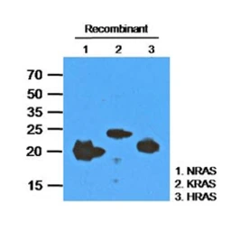 Anti-RAS antibody [AT2G9] used in Western Blot (WB). GTX57577