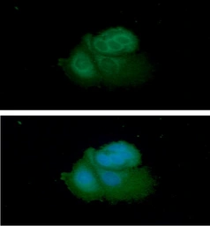 Anti-ARF1 antibody [1B3] used in Immunocytochemistry/ Immunofluorescence (ICC/IF). GTX57579