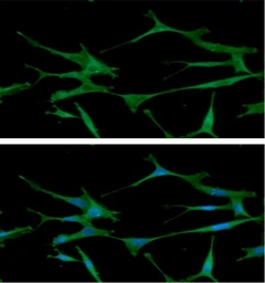Anti-ARF1 antibody [1B3] used in Immunocytochemistry/ Immunofluorescence (ICC/IF). GTX57579