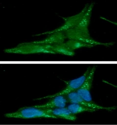 Anti-alpha Synuclein antibody [AT1E10] used in Immunocytochemistry/ Immunofluorescence (ICC/IF). GTX57587