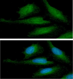 Anti-alpha Synuclein antibody [AT1E10] used in Immunocytochemistry/ Immunofluorescence (ICC/IF). GTX57587