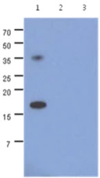 Anti-alpha Synuclein antibody [AT1E10] used in Western Blot (WB). GTX57587