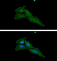 Anti-Cytokeratin 8 antibody [AT3D11] used in Immunocytochemistry/ Immunofluorescence (ICC/IF). GTX57589