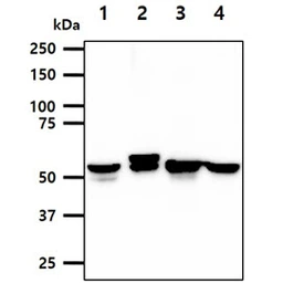 Anti-Cytokeratin 8 antibody [AT3D11] used in Western Blot (WB). GTX57589