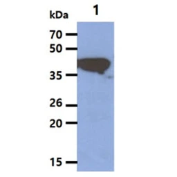 Anti-Cytokeratin 19 antibody [AT13D10] used in Western Blot (WB). GTX57591