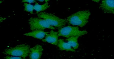 Anti-Cathepsin S antibody [AT1F9] used in Immunocytochemistry/ Immunofluorescence (ICC/IF). GTX57592