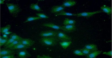 Anti-Cathepsin S antibody [AT1F9] used in Immunocytochemistry/ Immunofluorescence (ICC/IF). GTX57592