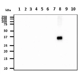 Anti-Cathepsin S antibody [AT1F9] used in Western Blot (WB). GTX57592