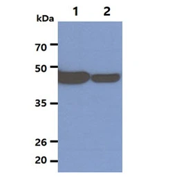 Anti-NSE antibody [AT17D10] used in Western Blot (WB). GTX57594