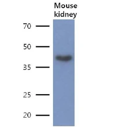 Anti-LRPAP1 antibody [AT8G8] used in Western Blot (WB). GTX57603