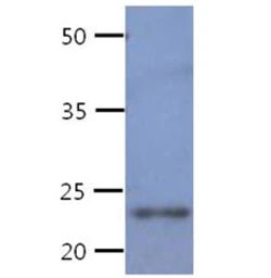 Anti-CREG1 antibody [AT1C6] used in Western Blot (WB). GTX57606