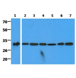 Anti-C1qBP antibody [AT1G7] used in Western Blot (WB). GTX57607