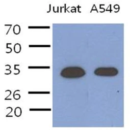 Anti-PDCL3 antibody [AT8F9] used in Western Blot (WB). GTX57608