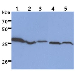 Anti-ACAT2 antibody [AT55D5] used in Western Blot (WB). GTX57610