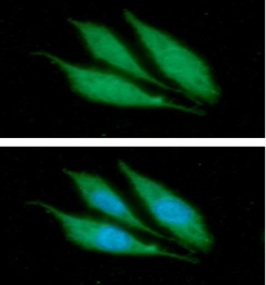 Anti-Cytokeratin 14 antibody [AT13F4] used in Immunocytochemistry/ Immunofluorescence (ICC/IF). GTX57611