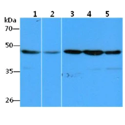 Anti-eEF1A1 antibody [AT23C11] used in Western Blot (WB). GTX57614