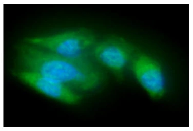 Anti-ACOT8 antibody [AT4D10] used in Immunocytochemistry/ Immunofluorescence (ICC/IF). GTX57615