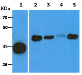 Anti-ACOT8 antibody [AT4D10] used in Western Blot (WB). GTX57615