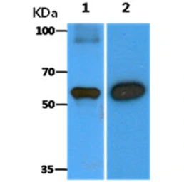 Anti-Beclin 1 antibody [AT45E8] used in Western Blot (WB). GTX57617