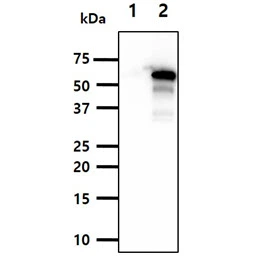 Anti-Beclin 1 antibody [AT45E8] used in Western Blot (WB). GTX57617