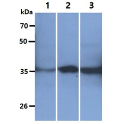 Anti-GOT2 antibody [AT8B11] used in Western Blot (WB). GTX57618
