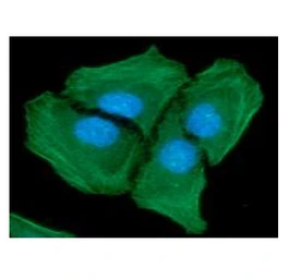 Anti-alpha Smooth Muscle Actin antibody [AT132D3] used in Immunocytochemistry/ Immunofluorescence (ICC/IF). GTX57619
