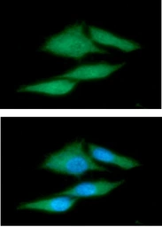 Anti-PSME1 antibody [AT12H3] used in Immunocytochemistry/ Immunofluorescence (ICC/IF). GTX57620