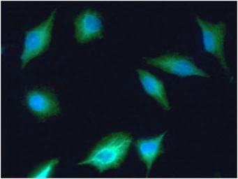 Anti-Fumarate hydratase antibody [AT3F6] used in Immunocytochemistry/ Immunofluorescence (ICC/IF). GTX57625