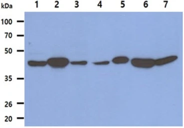 Anti-Fumarate hydratase antibody [AT3F6] used in Western Blot (WB). GTX57625