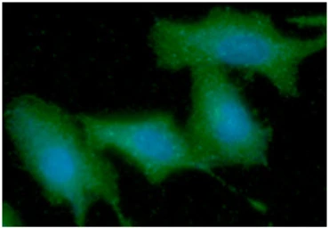 Anti-Cytokeratin 5 antibody [AT12C4] used in Immunocytochemistry/ Immunofluorescence (ICC/IF). GTX57627