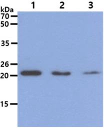 Anti-DHFR antibody [AT5B2] used in Western Blot (WB). GTX57632