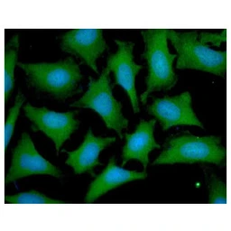 Anti-OTUB1 antibody [AT17E10] used in Immunocytochemistry/ Immunofluorescence (ICC/IF). GTX57636