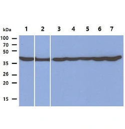 Anti-PGK1 antibody [AT2F4] used in Western Blot (WB). GTX57637