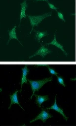 Anti-S100A4 antibody [AT1C3] used in Immunocytochemistry/ Immunofluorescence (ICC/IF). GTX57640